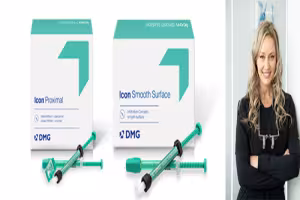 Dental Professionals Invited to Free CE Webinar on Resin Infiltration for Predictable Clinical Results