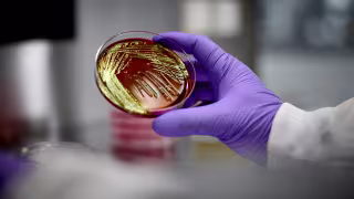 Roche Receives FDA Breakthrough Device Designation for AI-Driven Lung Cancer Diagnostic