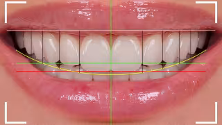 Digital Dentistry Reshaping Aesthetic Treatment: Benefits, Innovations, and Market Impacts