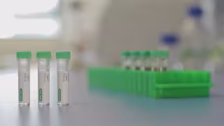 Bio-Rad Expands Anti-Idiotypic Antibody Portfolio and SpyCatcher Reagent Line for Bioanalysis Innovation