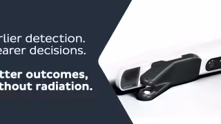 Empowering Early Caries Management with KaVo DIAGNOcam Vision Full HD