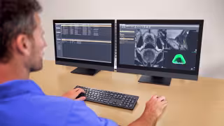 Philips UroNav 2.0 Earns FDA Clearance, Elevating Image-Guided Prostate Cancer Therapy