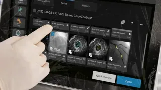 Philips Expands AI-Guided Cardiology Workflow Strategy With Low-Dose Imaging Innovations at EuroPCR 2026