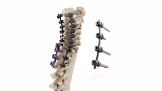 CMS Grants NTAP Reimbursement for icotec's CMORE CT Spine Implant