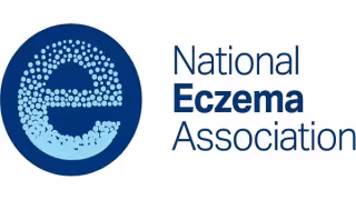 CDC-Funded Report Finds 80% of U.S. Atopic Dermatitis Cases Undiagnosed