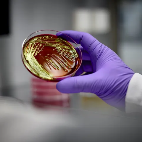 Roche Receives FDA Breakthrough Device Designation for AI-Driven Lung Cancer Diagnostic