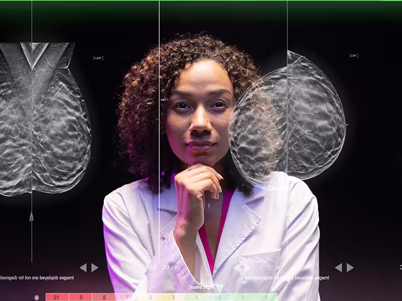 Hologic Presents Groundbreaking AI-Powered Mammography Technology at SBI 2025 Symposium