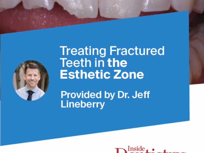 Ecosite Elements Showcased in Inside Dentistry for Breakthrough Esthetic Restoration