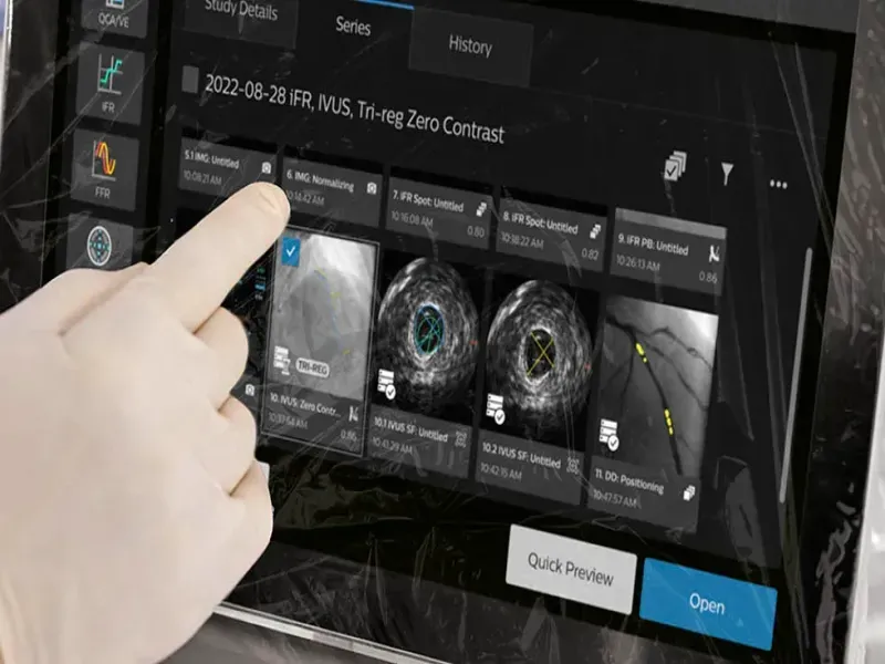 Philips Expands AI-Guided Cardiology Workflow Strategy With Low-Dose Imaging Innovations at EuroPCR 2026