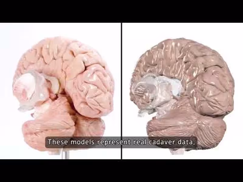 Anatomage Launches 3D-Printed Cadaver-Based Anatomy Models