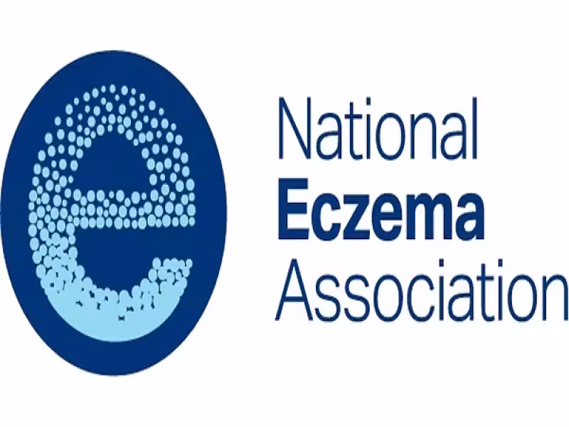 CDC-Funded Report Finds 80% of U.S. Atopic Dermatitis Cases Undiagnosed
