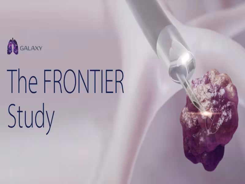 Noah Medical's Galaxy System Hits 100% Tool-in-Lesion Accuracy in Trial